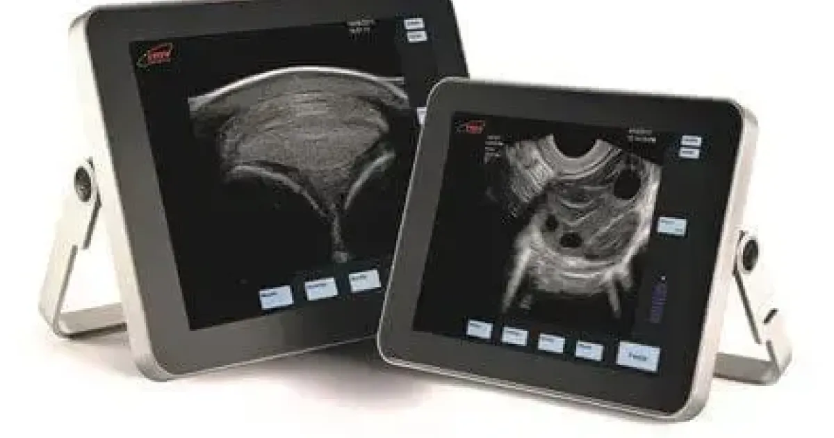 Échographe Vétérinaire Professionnel Globus Ultrasoundvet 4000 - Blanc/Bleu - Neuf Sous Garantie